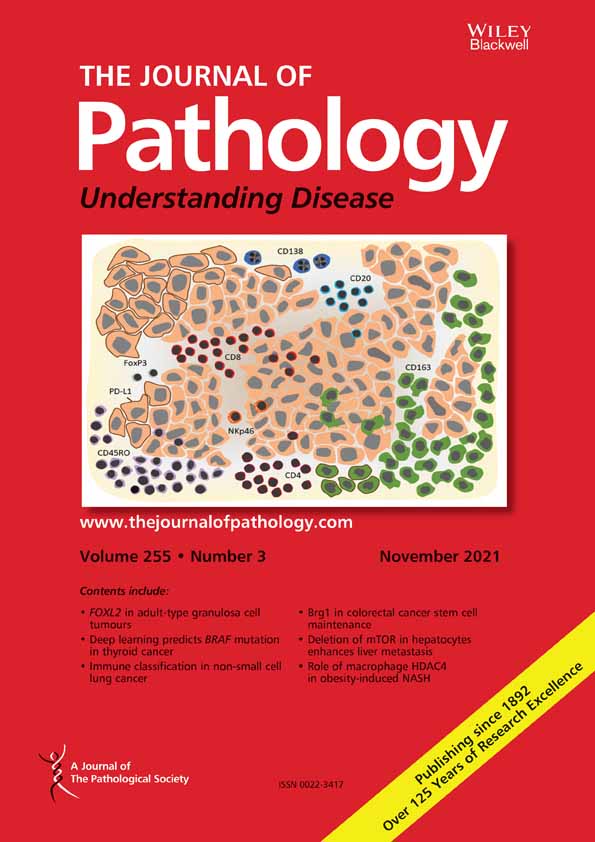 A digital score of tumour‐associated stroma infiltrating lymphocytes predicts survival in head and neck squamous cell carcinoma