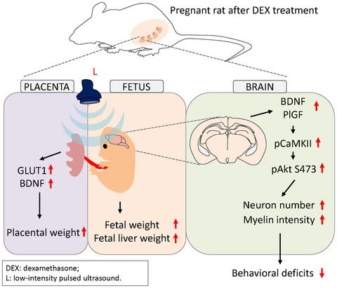 Antenatal low‐intensity pulsed ultrasound reduces neurobehavioral deficits and brain injury following dexamethasone‐induced intrauterine growth restriction