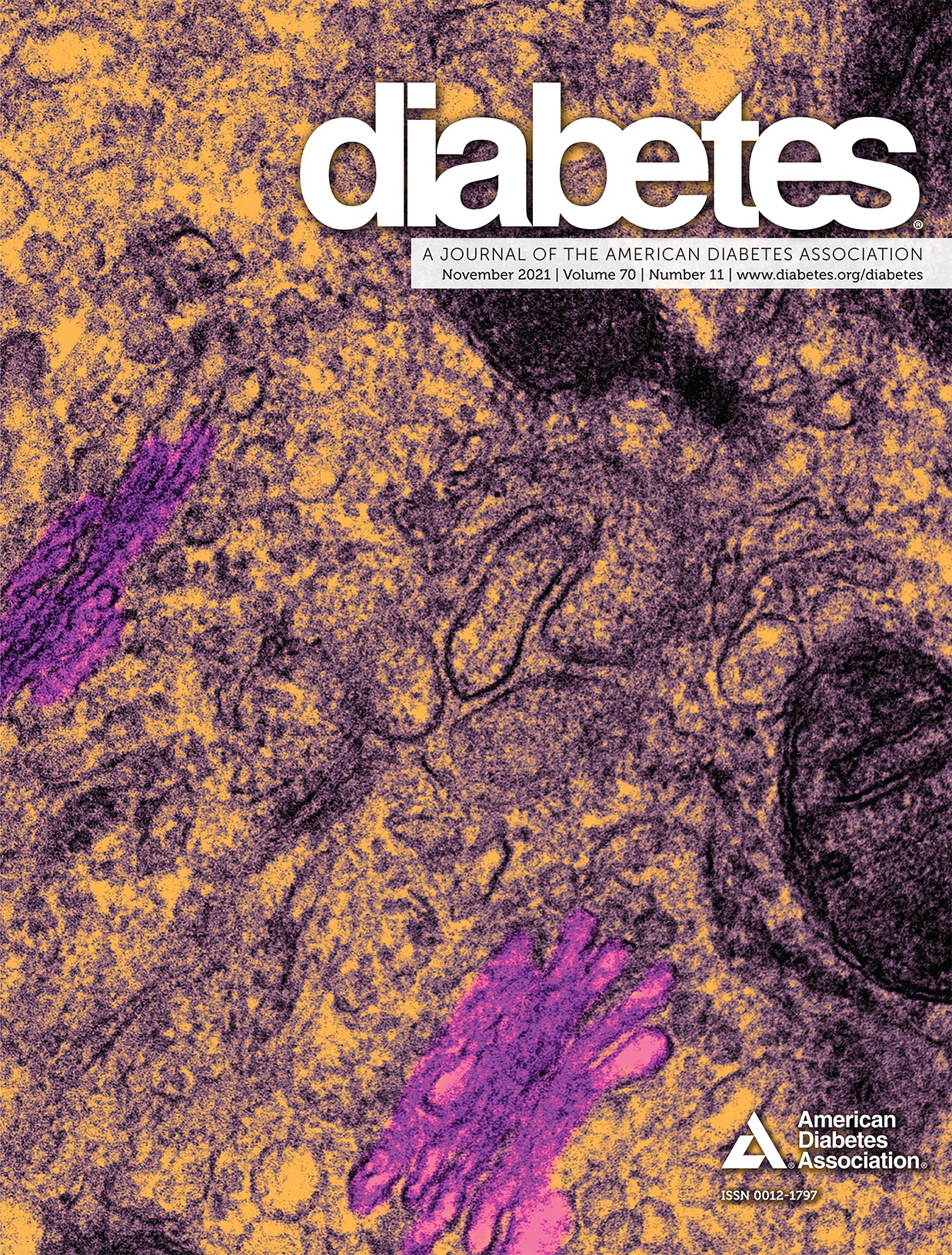 VDR/Atg3 Axis Regulates Slit Diaphragm to Tight Junction Transition via p62-Mediated Autophagy Pathway in Diabetic Nephropathy