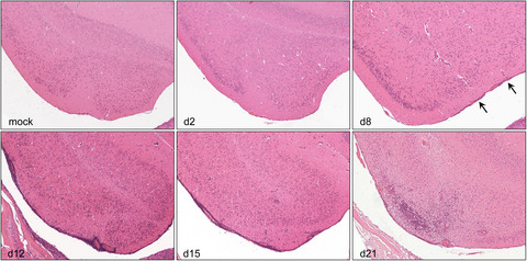 Clinical, neuropathological, and immunological short‐ and long‐term feature of a mouse model mimicking human herpes virus encephalitis