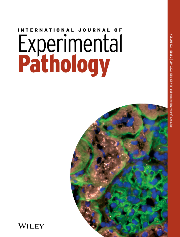 Soy diet induces intestinal inflammation in adult Zebrafish: Role of OTX and P53 family