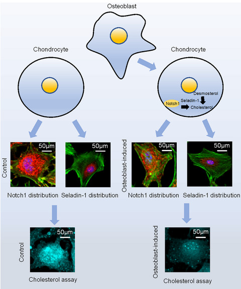 Osteoblasts impair cholesterol synthesis in chondrocytes via Notch1 signalling