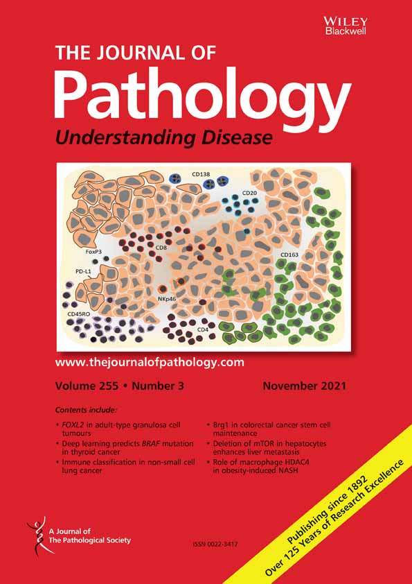 BCG invokes superior STING‐mediated innate immune response over radiotherapy in a carcinogen murine model of urothelial cancer