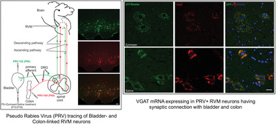 Identification and characterization of rostral ventromedial medulla neurons synaptically connected to the urinary bladder afferents in female rats with or without neonatal cystitis