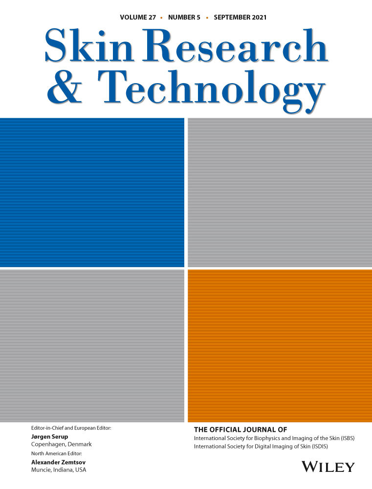 Reflectance confocal microscopy of multiple idiopathic eruptive macular pigmentation: A case report