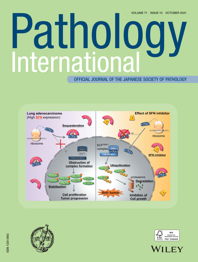 Investigation of IgG4‐positive cells in idiopathic multicentric Castleman disease and validation of the 2020 exclusion criteria for IgG4‐related disease