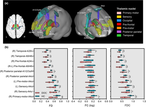 Microstructural profiles of thalamus and thalamocortical connectivity in patients with disorder of consciousness