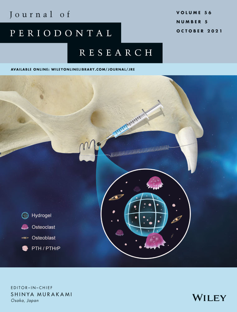 Activation of GATA‐binding protein 4 regulates monocyte chemoattractant protein‐1 and chemotaxis in periodontal ligament cells