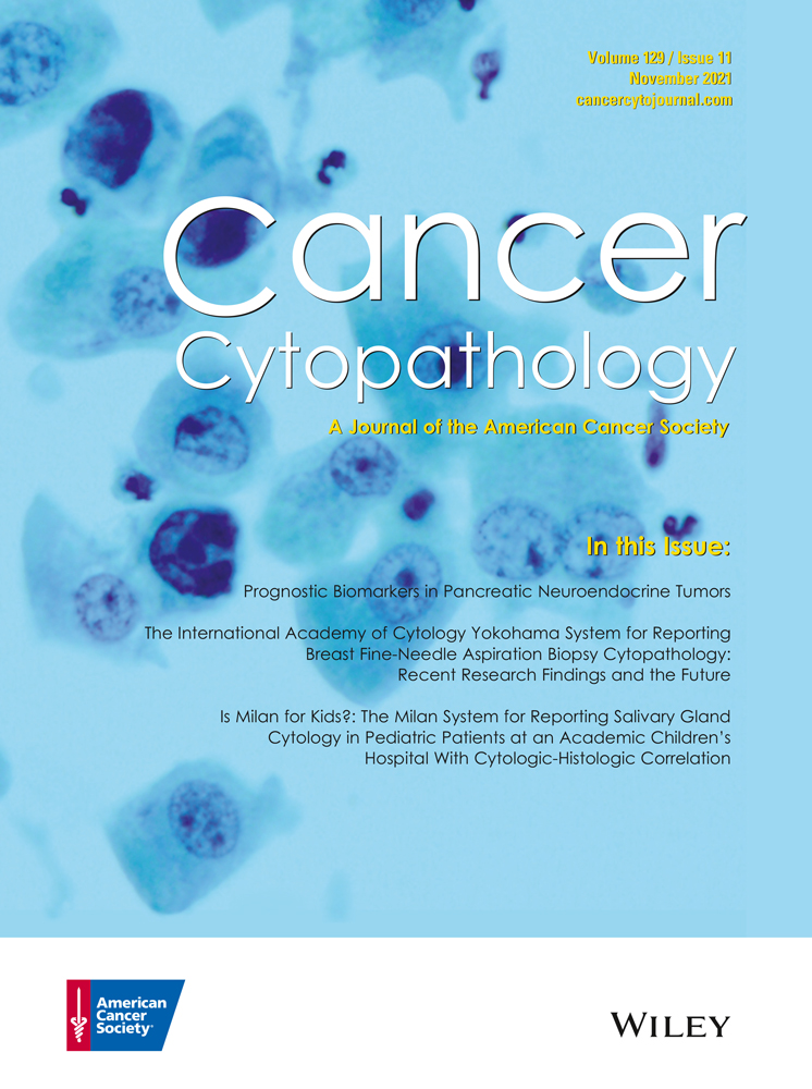 Serial FNA allows direct sampling of malignant and infiltrating immune cells in patients with B‐cell lymphoma receiving immunotherapy
