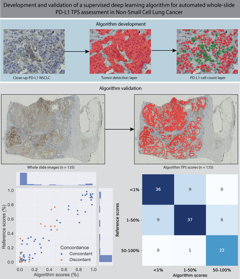Development and validation of a supervised deep learning algorithm for automated whole‐slide programmed death‐ligand 1 tumour proportion score assessment in non‐small cell lung cancer