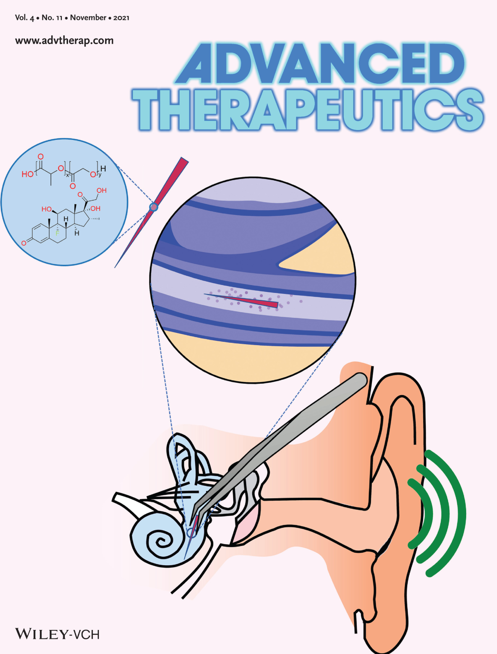 Dexamethasone (DXM)‐Coated Poly(lactic‐co‐glycolic acid) (PLGA) Microneedles as an Improved Drug Delivery System for Intracochlear Biodegradable Devices (Adv. Therap. 11/2021)