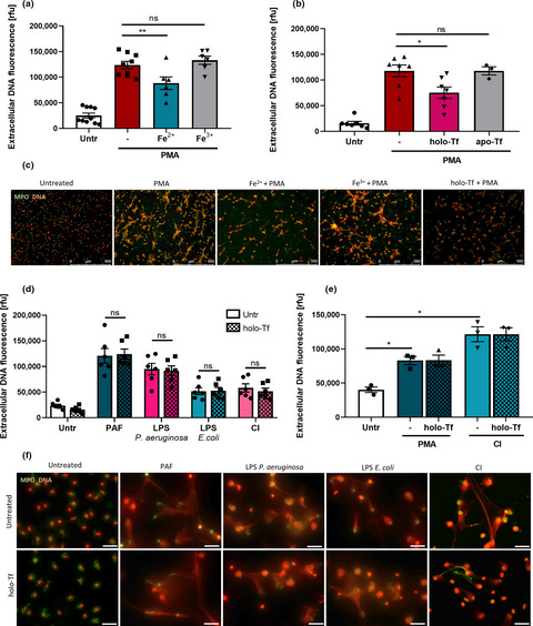 Iron excess affects release of neutrophil extracellular traps and reactive oxygen species but does not influence other functions of neutrophils