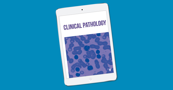 Chondromyxoid Fibroma-Like Osteosarcoma in a 13 Years Old Girl: A Report of a New Case