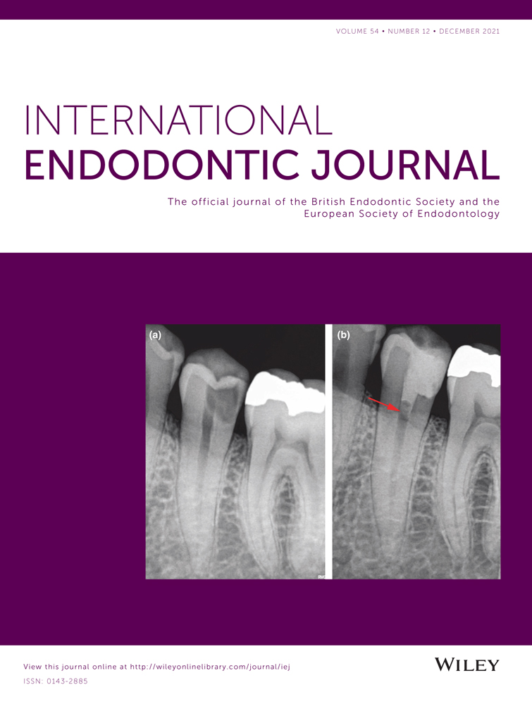 A critical appraisal of research methods and experimental models for studies on root canal preparation