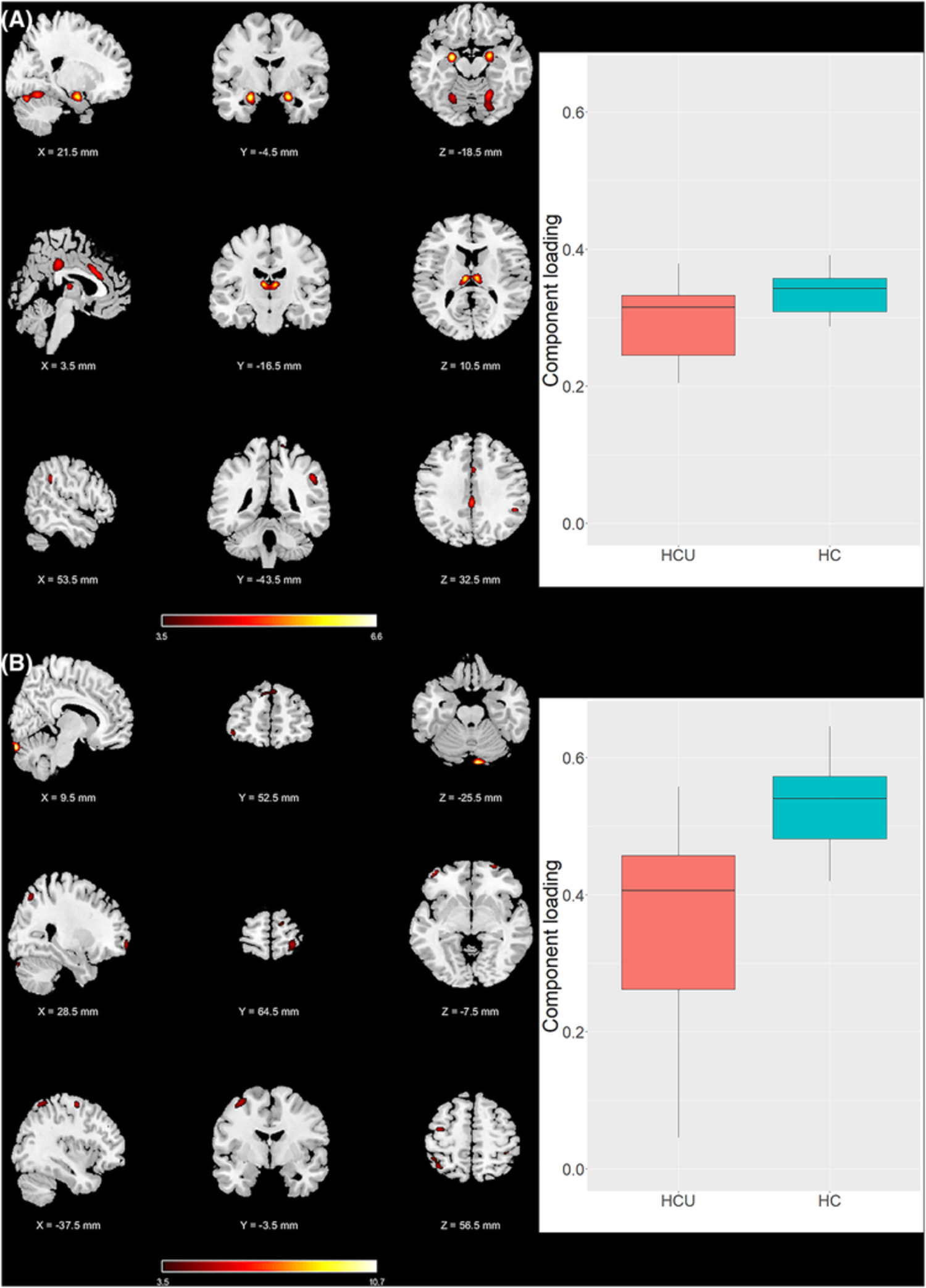 Multimodal MRI data fusion reveals distinct structural, functional and neurochemical correlates of heavy cannabis use