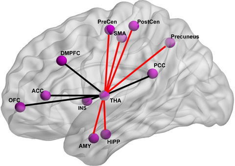 Functional constipation is associated with alterations in thalamo‐limbic/parietal structural connectivity