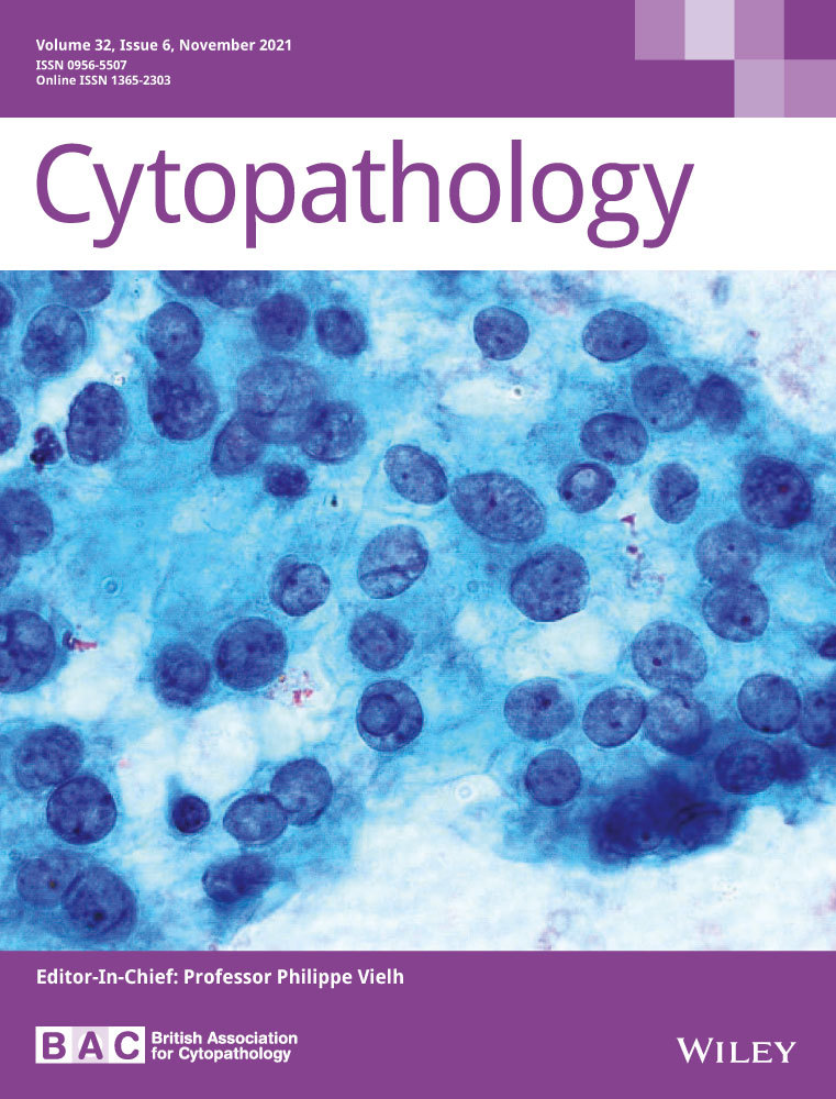 Real‐world experience with the Sydney System on 1458 cases of Lymph Node Fine‐Needle Aspiration Cytopathology.