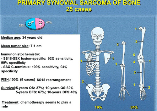 Primary synovial sarcoma of bone: A retrospective analysis of 25 patients