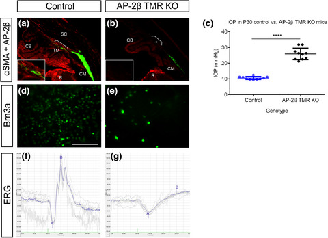 Deletion of transcription factor AP‐2β from the developing murine trabecular meshwork region leads to progressive glaucomatous changes
