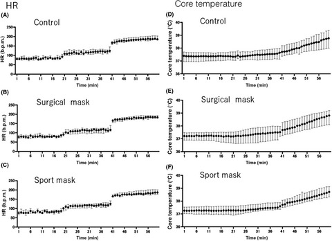 Wearing a face mask during controlled‐intensity exercise is not a risk factor for exertional heatstroke: A pilot study