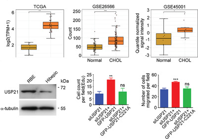 USP21 upregulation in cholangiocarcinoma promotes cell proliferation and migration in a deubiquitinase‐dependent manner