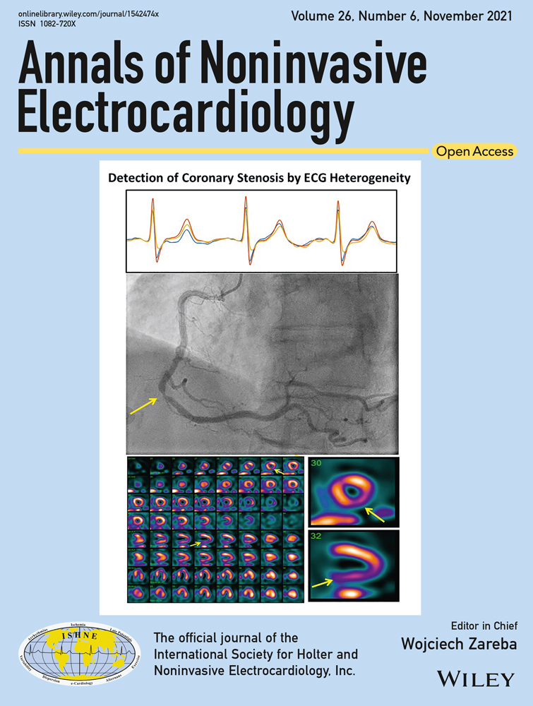 Relationship between electrocardiogram‐based features and personality traits: Machine learning approach