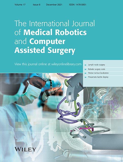 Design of interactive augmented reality functions for robotic surgery and evaluation in dry‐lab lymphadenectomy