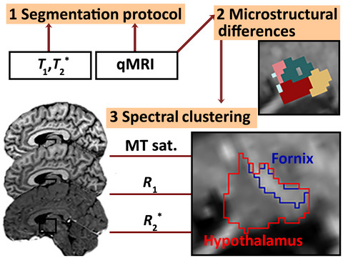 Quantitative magnetic resonance imaging for segmentation and white matter extraction of the hypothalamus