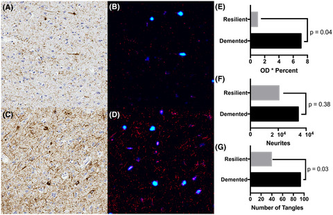 Application of deep learning to understand resilience to Alzheimer's disease pathology