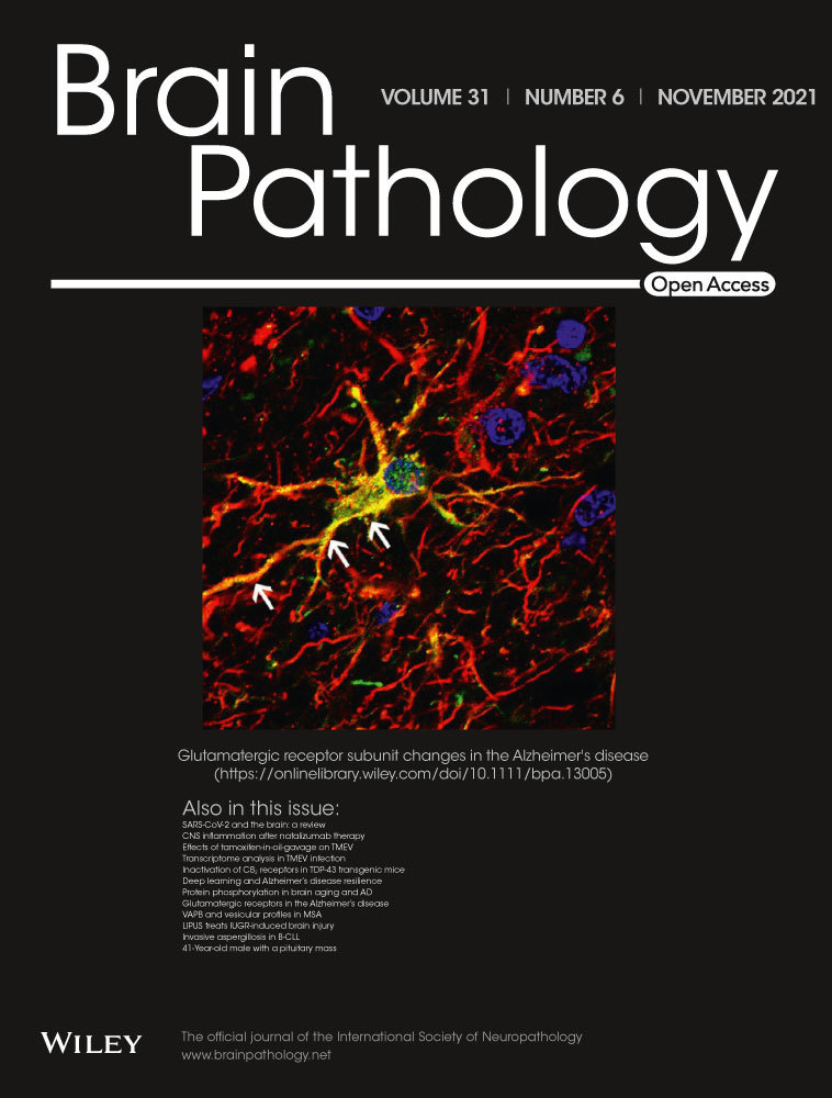 Inactivation of the CB2 receptor accelerated the neuropathological deterioration in TDP‐43 transgenic mice, a model of amyotrophic lateral sclerosis