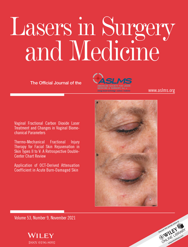 Application of OCT‐Derived Attenuation Coefficient in Acute Burn‐Damaged Skin
