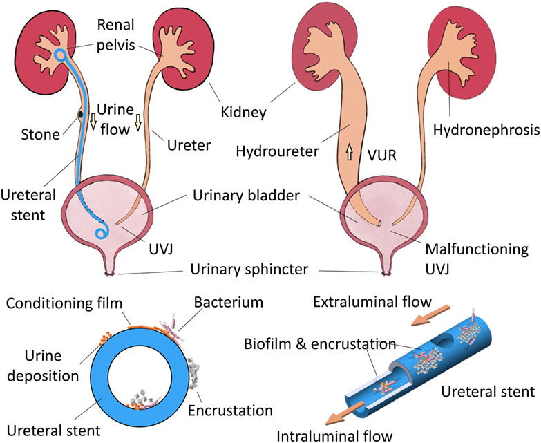 Fluid mechanical modeling of the upper urinary tract