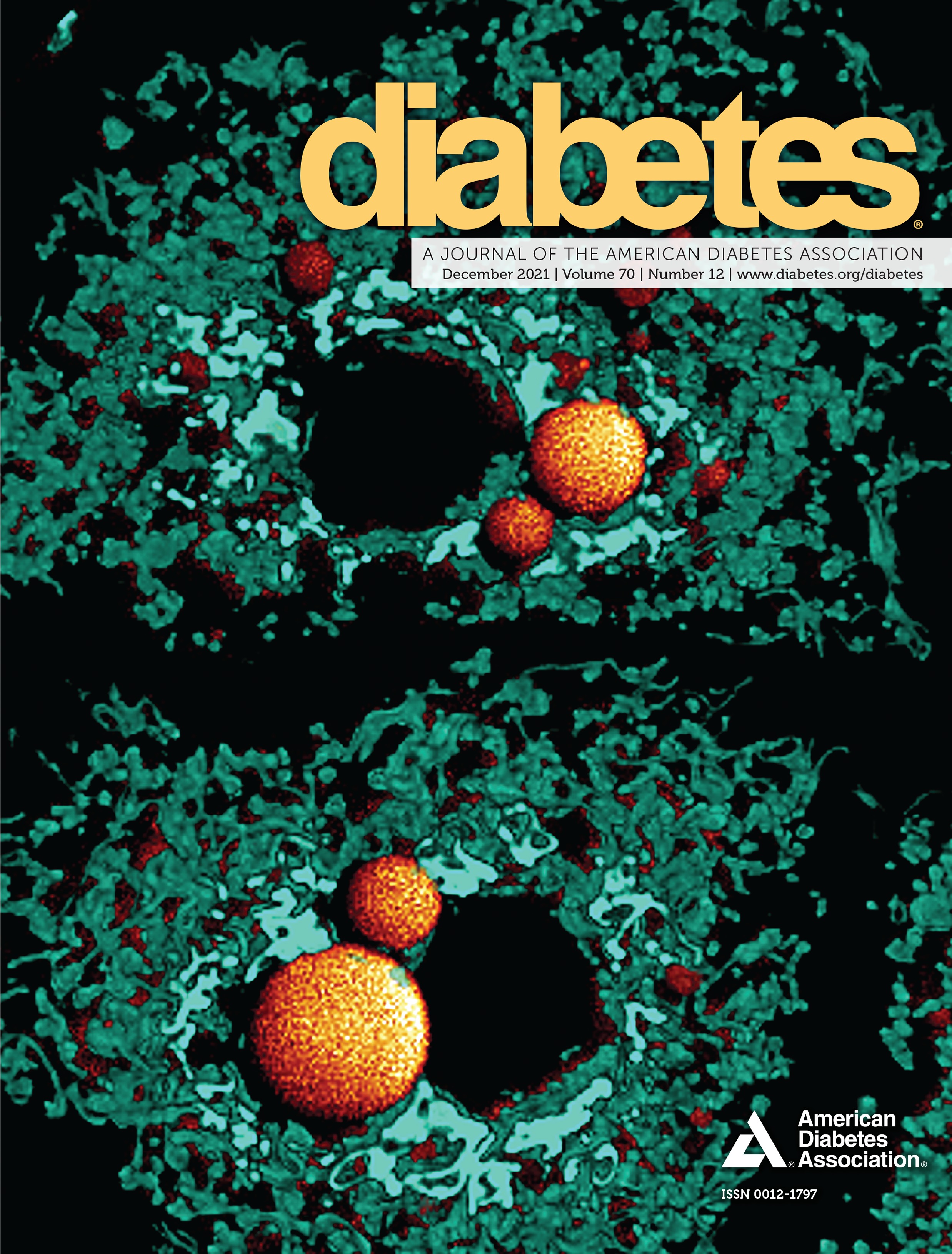Reduced Follicular Regulatory T Cells in Spleen and Pancreatic Lymph Nodes of Patients With Type 1 Diabetes