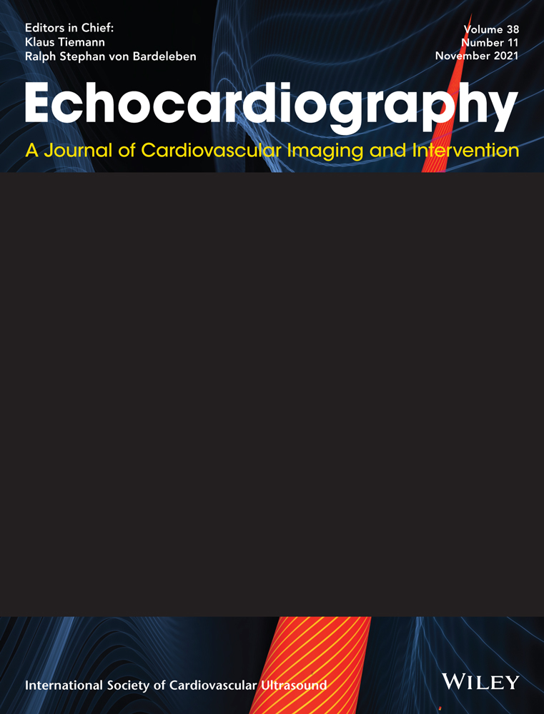 A case of massive left atrial thrombus