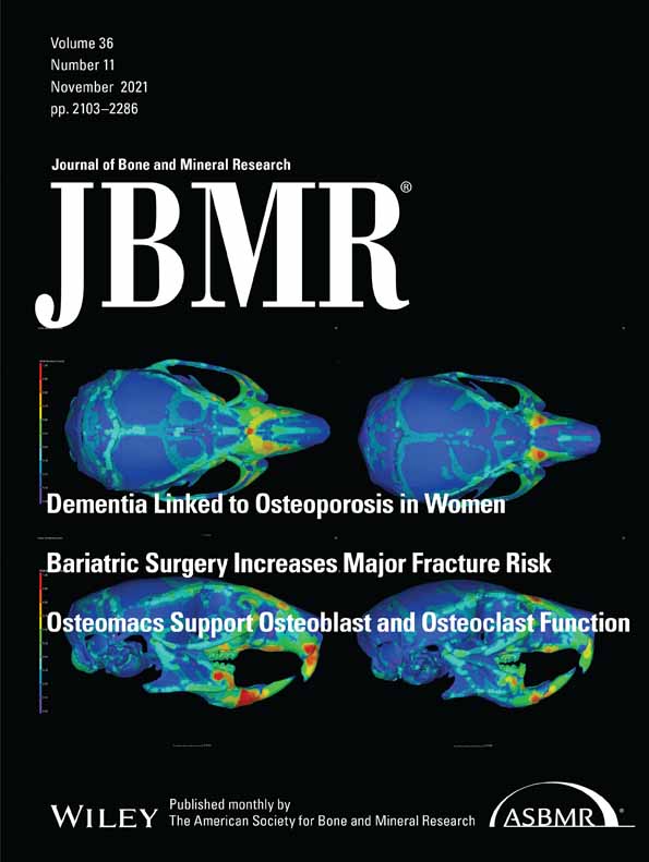 Hedgehog signaling controls bone homeostasis by regulating osteogenic/adipogenic fate of skeletal stem/progenitor cells in mice