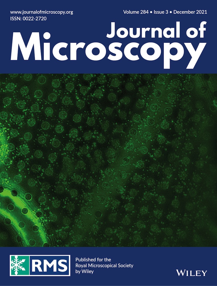 Implications of gnomonic distortion on electron backscatter diffraction and transmission kikuchi diffraction