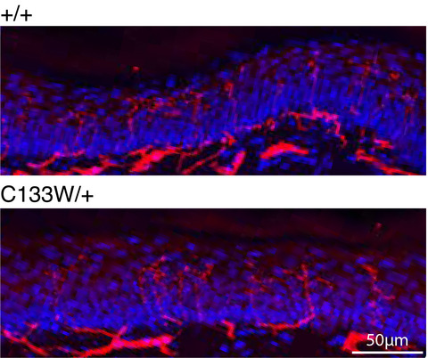 Precision mouse models of Yars/dominant intermediate Charcot‐Marie‐Tooth disease type C and Sptlc1/hereditary sensory and autonomic neuropathy type 1