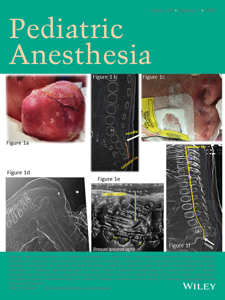 Anesthetic considerations in children with asthma