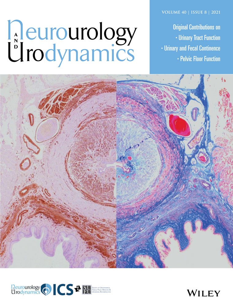 Prevalence of LUTS and urodynamics results in obese women