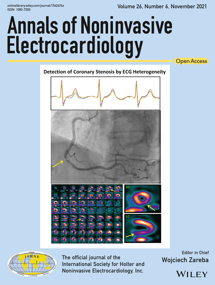 Risk factors for late recurrence in patients with nonvalvular atrial fibrillation after radiofrequency catheter ablation