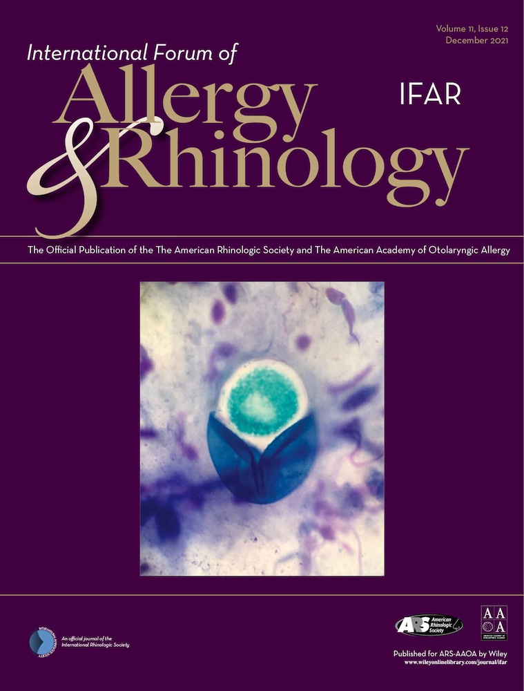 Nasal inflammatory profile in patients with COVID‐19 Olfactory Dysfunction