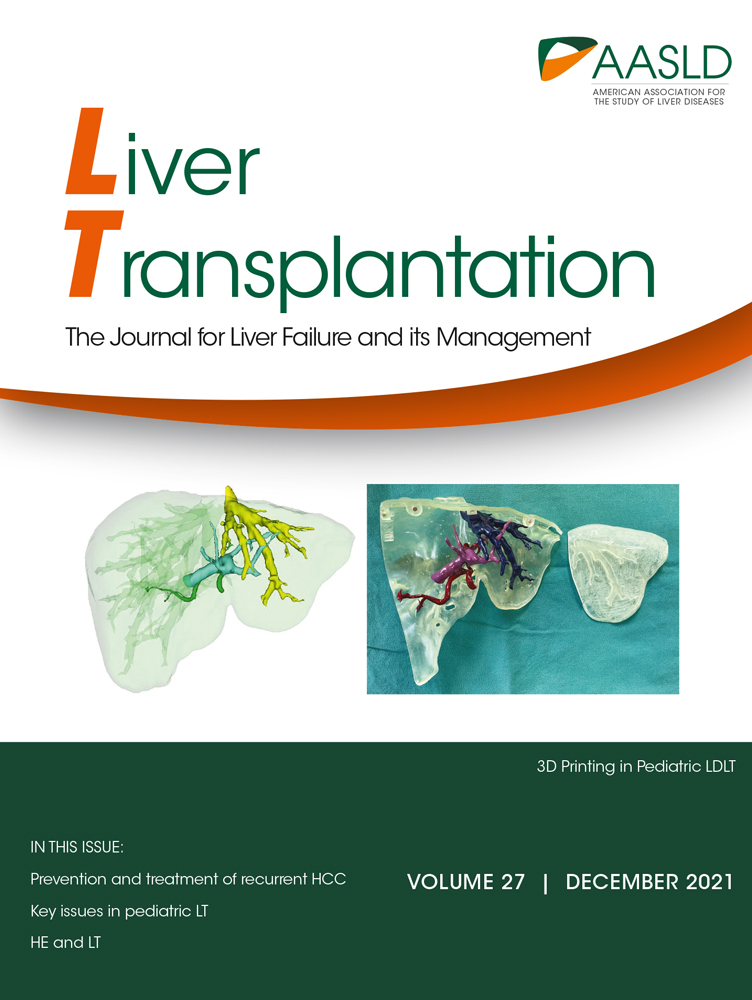 Outcome of Extended Right Lobe Liver Transplantations