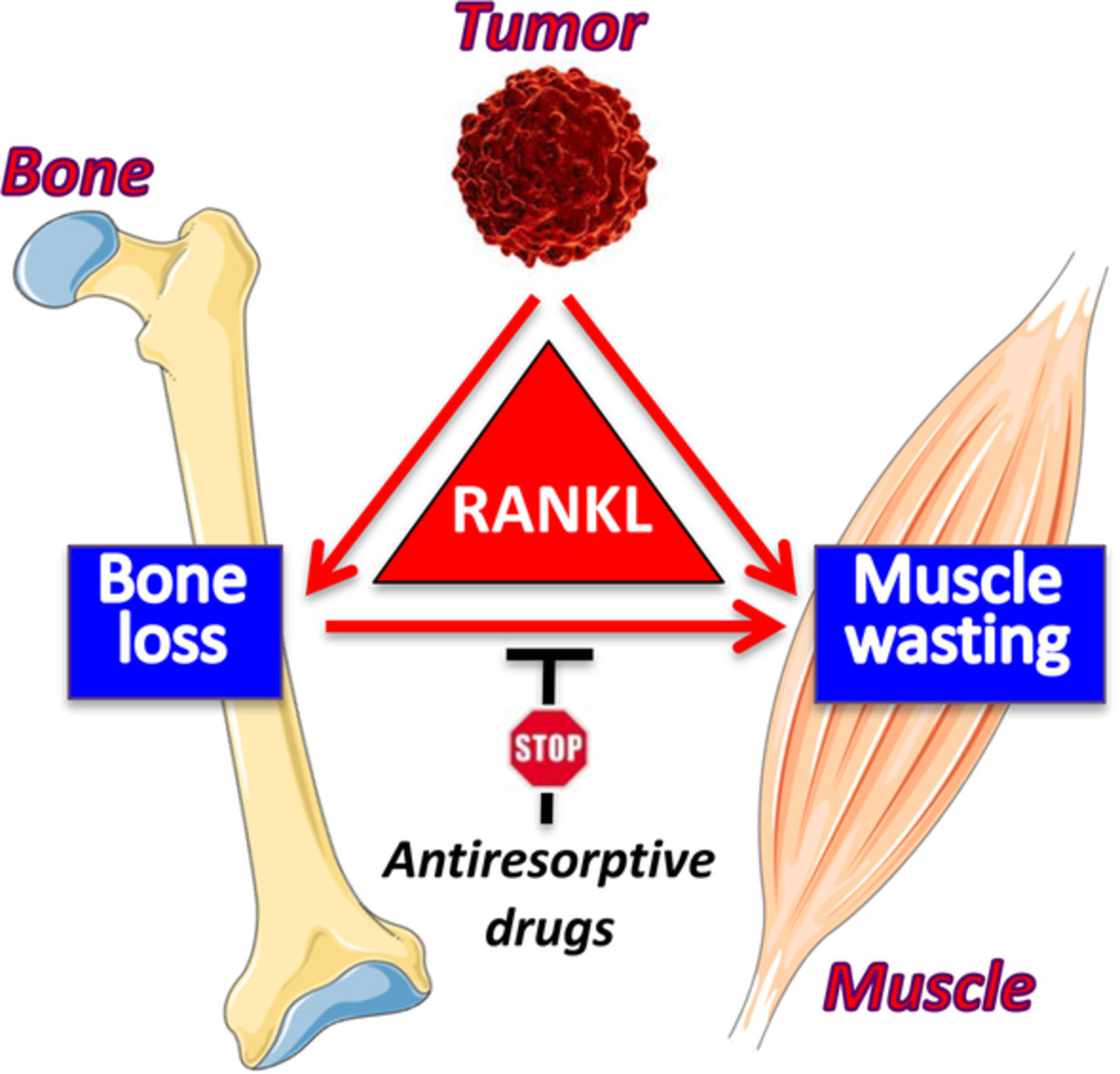 RANKL Blockade Reduces Cachexia and Bone Loss Induced by Non‐Metastatic Ovarian Cancer in Mice