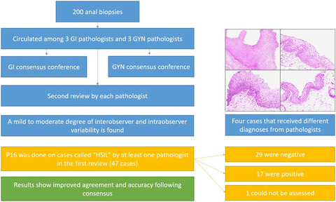 Interobserver agreement in the diagnosis of anal dysplasia: comparison between gastrointestinal and gynaecological pathologists and utility of consensus conferences