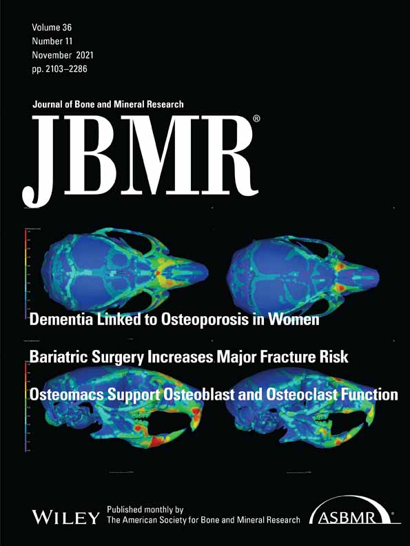 Shared genetic architecture between rheumatoid arthritis and varying osteoporotic phenotypes