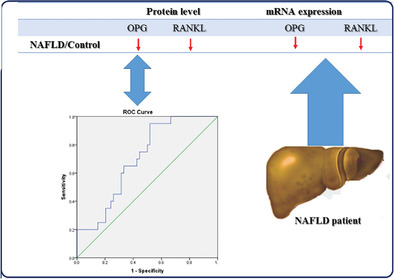 Circulating mRNA and plasma levels of osteoprotegerin and receptor activator of NF‐κB ligand in nonalcoholic fatty liver disease