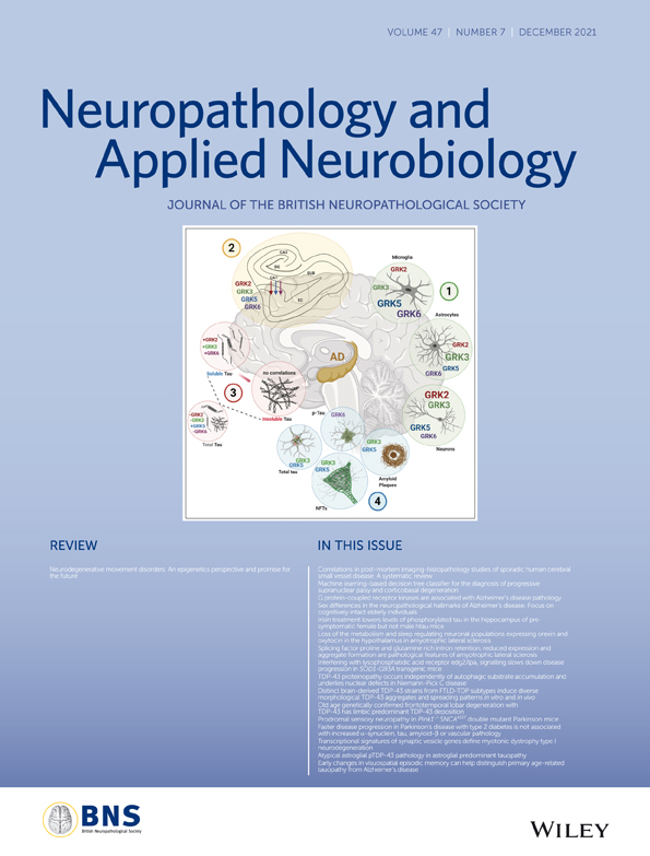 Brain TDP‐43 pathology in corticobasal degeneration: topographical correlation with neuronal loss