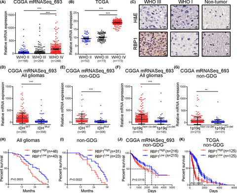 Retinol binding protein 1‐dependent activation of NF‐ κB signaling enhances the malignancy of non‐glioblastomatous diffuse gliomas