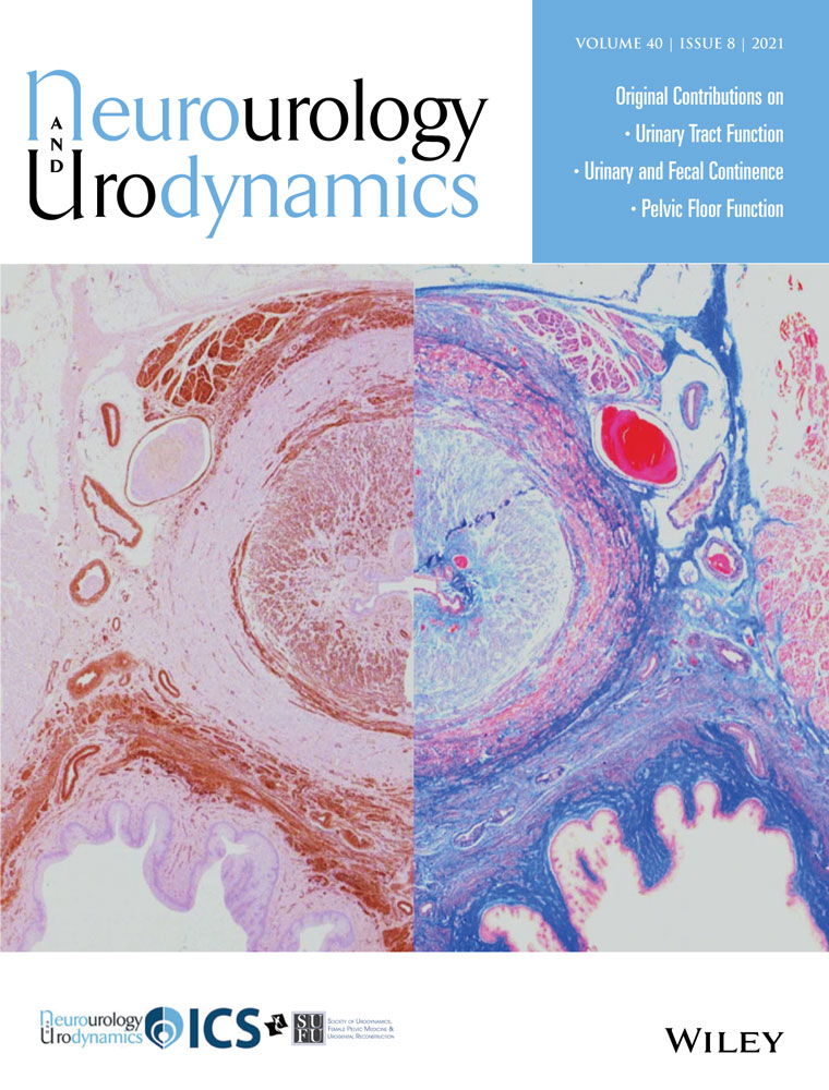 Sensation of incomplete bladder emptying in women: Lack of correlation to an elevated post‐void residual