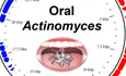 Adaptively evolved human oral actinomyces‐sourced defensins show therapeutic potential